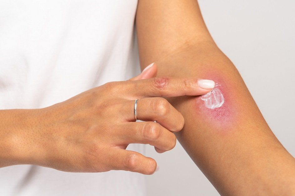 Kopfbild zum Artikel