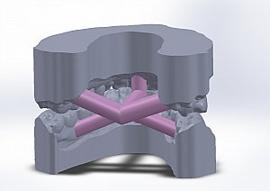Intraoralscanner - digitalen Scan in Praxis und Labor nutzen