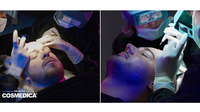 Haartransplantation-Türkei-All-inclusive Prozess in der Cosmedica Clinic Haartransplantation-Türkei-All-inclusive Prozess in der Cosmedica Clinic