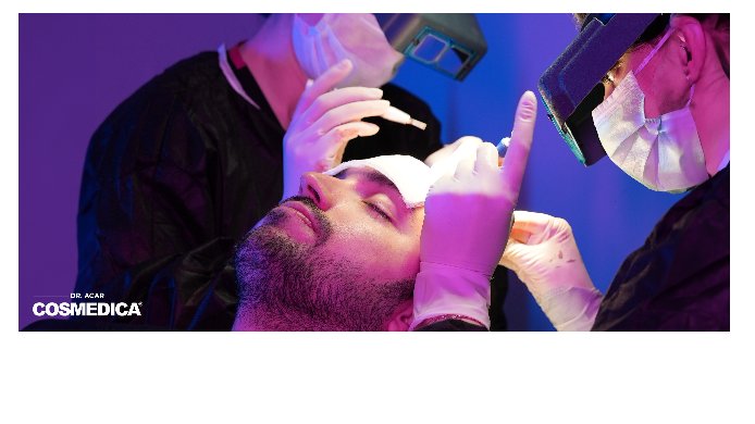 Beste Haartransplantation: Türkei setzt Maßstäbe Beste Haartransplantation: Türkei setzt Maßstäbe