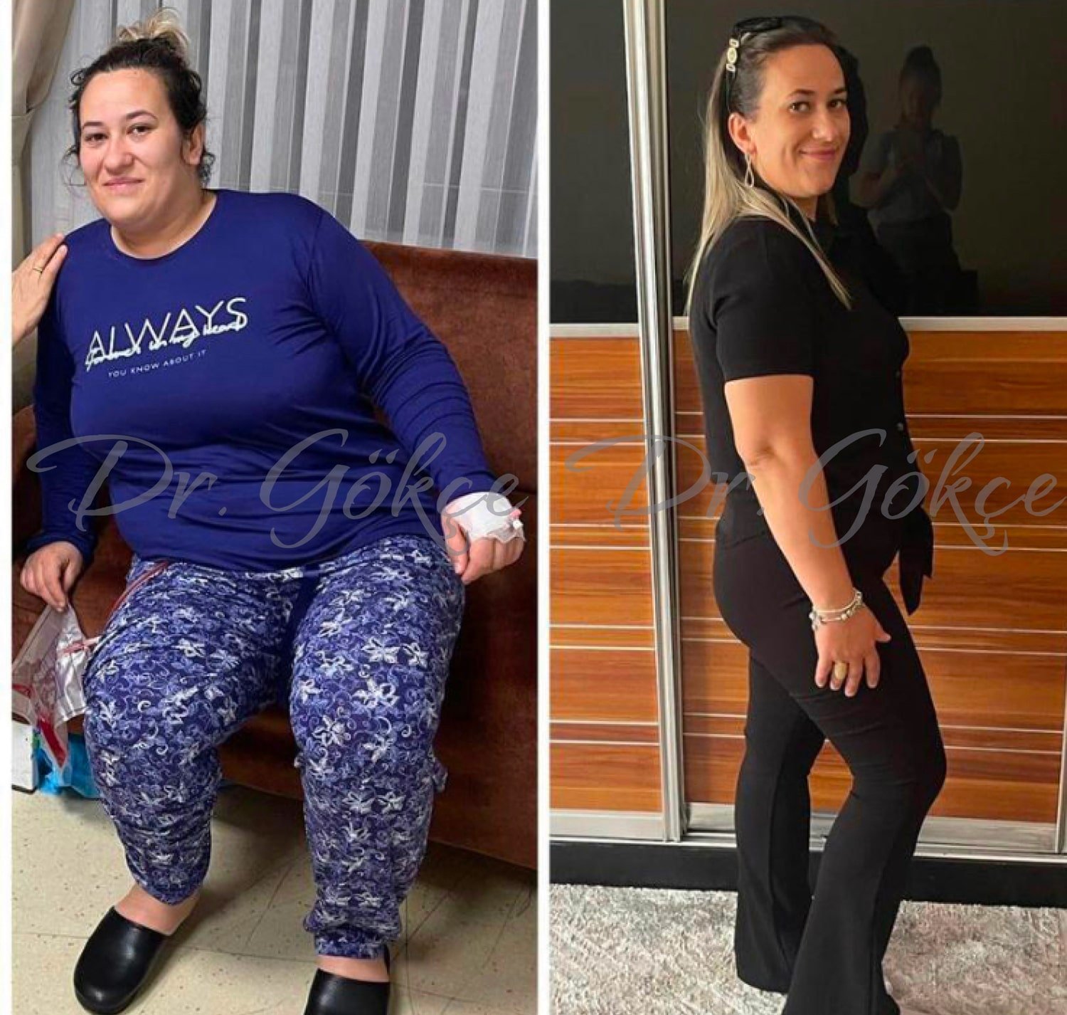 Magenverkleinerung Kosten in der Türkei