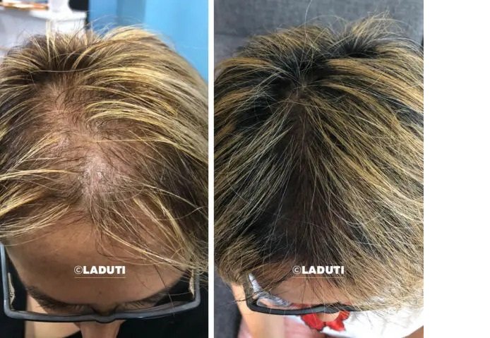 LADUTI: Erfahrungen der Kunden