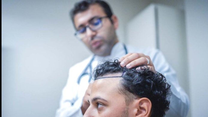 Testsieger Haartransplantation Türkei