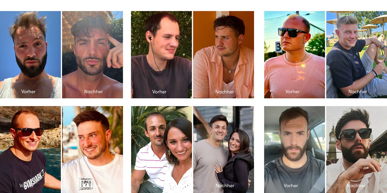 Haarsystem im Vergleich: O.C. Hairsystems