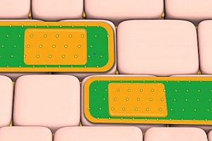 Kijimea® Reizdarm PRO Erfahrungen | Kijimea® Reizdarm PRO Test