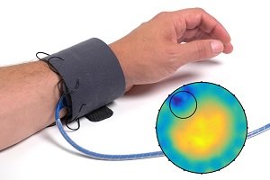 Bild zum Artikel: Elektrische Impedanztomographie