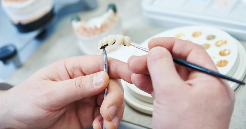 Zahnersatz finanzieren